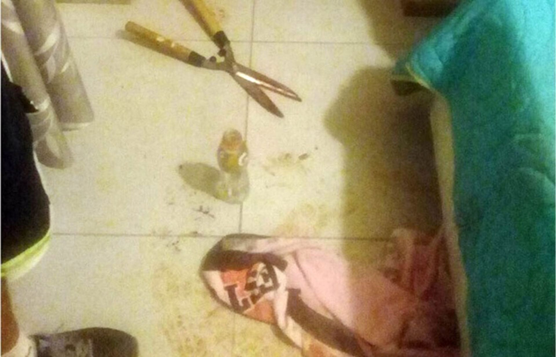 Mujer aprovechó que su esposo estaba borracho para cortarle el pene