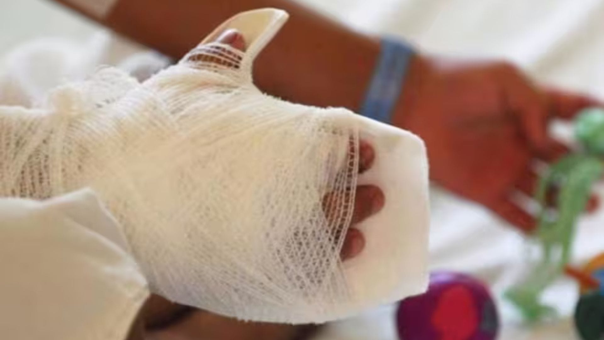 20 quemados con pólvora en un solo día en el Cauca: la mayoría son menores de edad