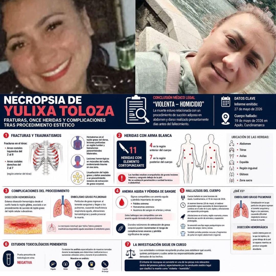Informe forense sobre muerte de Yulixa Toloza revela graves lesiones y abre nuevas dudas sobre procedimiento estético