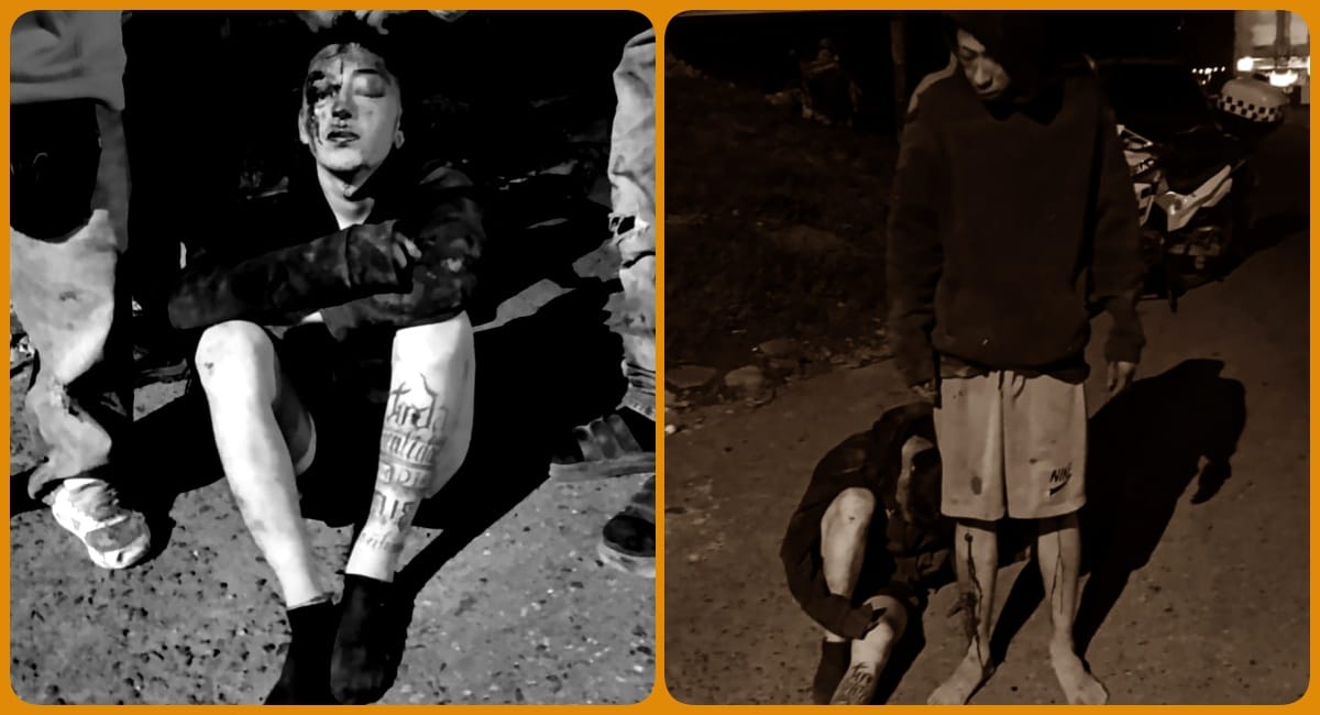 Salieron a robar, la comunidad los sorprendió y los golpearon hasta dejarlos gravemente heridos