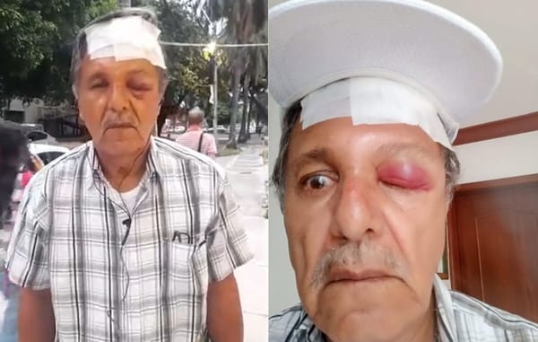 Por pedirle a un motociclista que no manejara por el andén, el abuelo Hugo Romero fue golpeado brutalmente con un casco