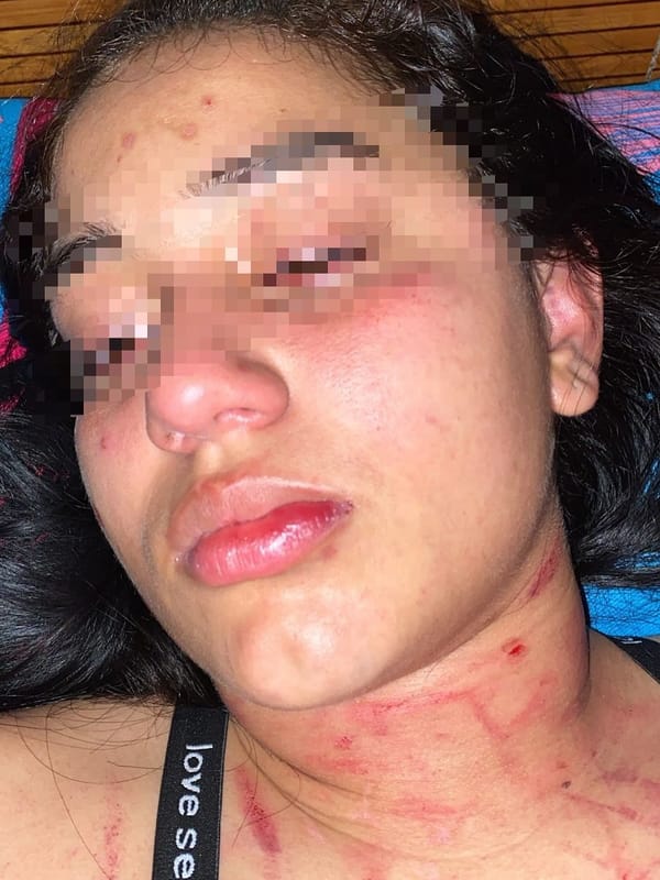 Guardián del Inpec es señalado de agredir físicamente a su pareja en un caso de violencia de género