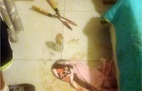Mujer aprovechó que su esposo  estaba borracho para cortarle el pene
