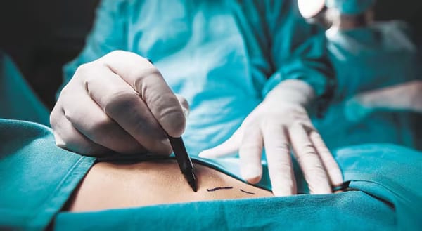 Condenan a peluquera por muerte de mujer en cirugía estética ilegal