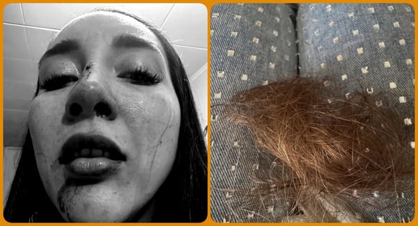 “Temo por mi seguridad y la de mi hijo”: mujer denuncia agresión de su ex pareja en Popayán