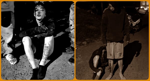 Salieron a robar, la comunidad los sorprendió y los golpearon hasta dejarlos gravemente heridos